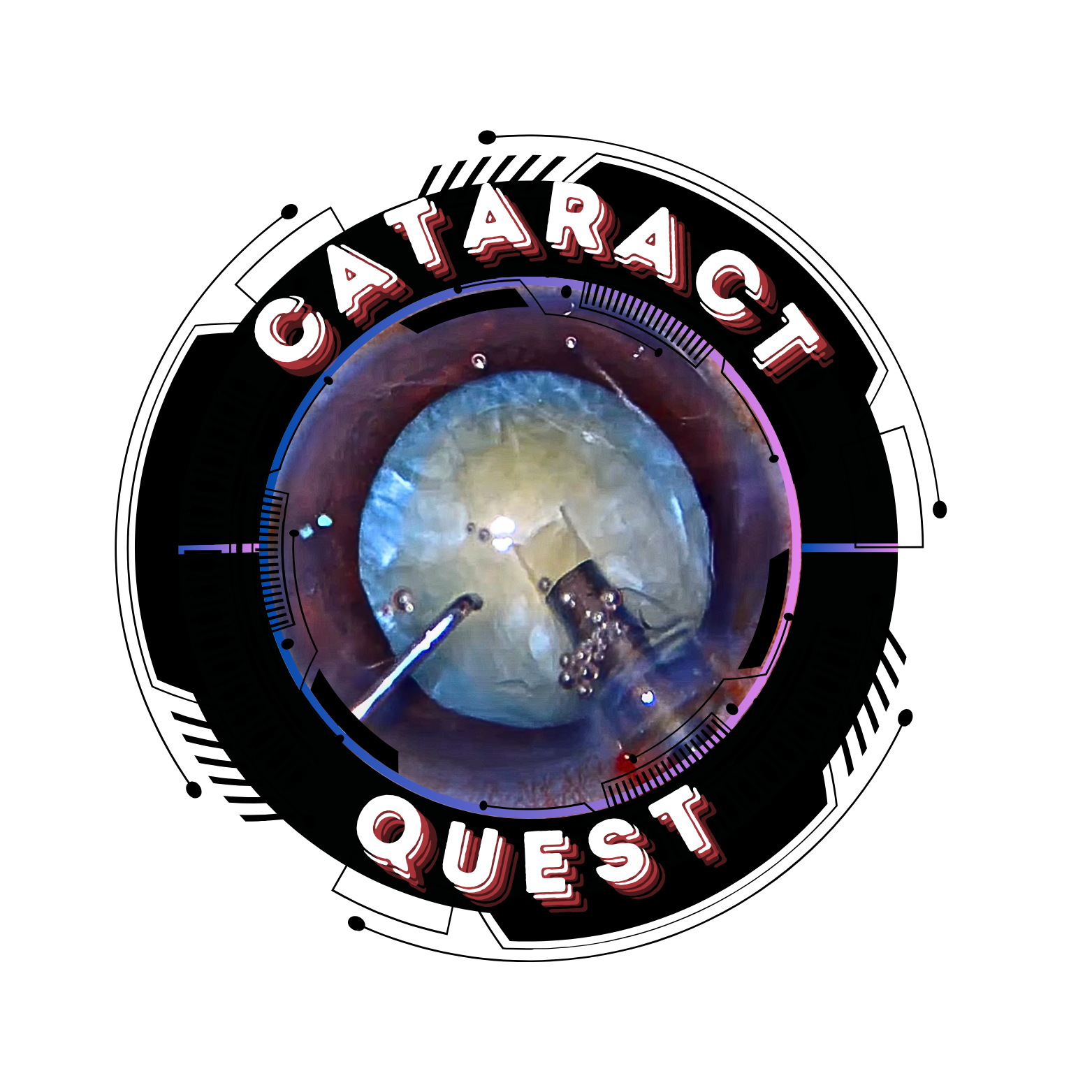 Cataract Quest